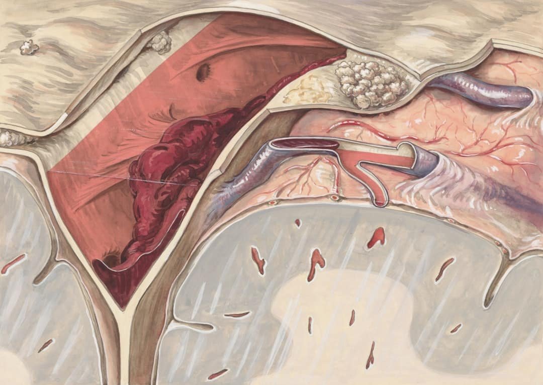 Photo Rhinoplasty